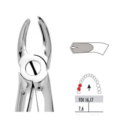 Forceps Upper Molars Right (Unodent) No.17 Stainless Steel Reusable x 1