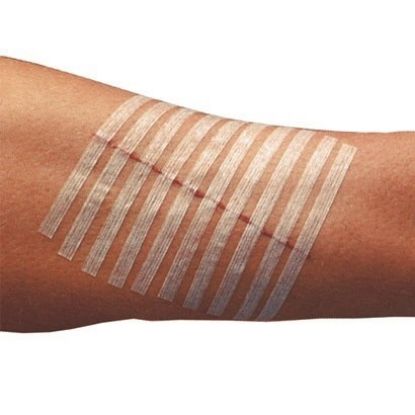 Steristrip Closure Strips - Various Options Available