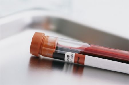 Picture for category Blood Testing