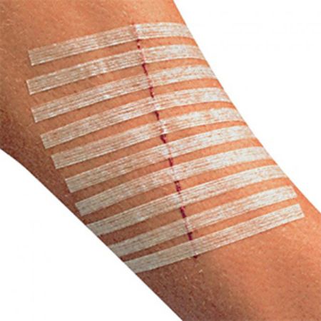 Picture for category Skin Closure Strips